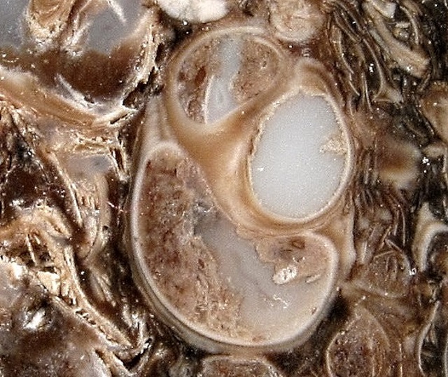 Gastropod Fossilized Snails Which Have Been Replace By Agate. The Snail Is The Geneus Turritella, A High Spired Slender Ceithiid
